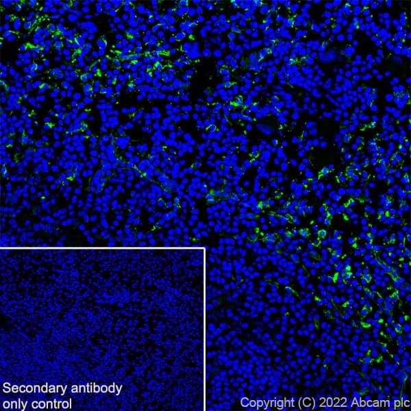 Anti-Mannose Receptor antibody [EPR25215-277](AB300621)