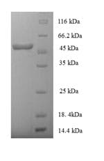 Recombinant Human HLA E protein (Tagged)(AB235846)