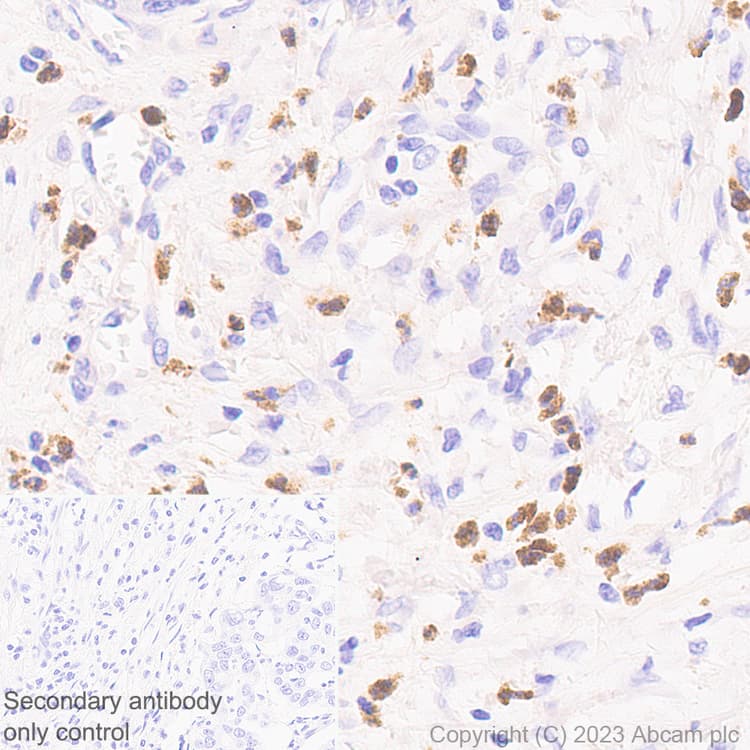 Anti-MMP9 antibody [RM1020](AB283575)