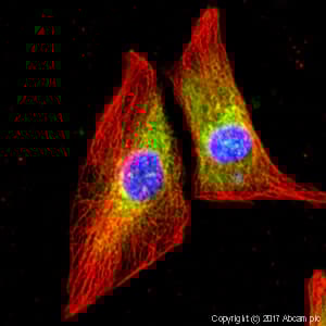 Anti-FMRP antibody(AB17722)