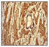 Anti-Cathepsin D antibody [EPR3057Y](ab75852)