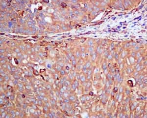 Cap1 Antibody Epr8339b Ab155079  Immunohistochemistry Formalin Pfa Fixed Paraffin Embedded Sections Img124160