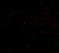 Anti-HAPLN2 antibody(AB124504)