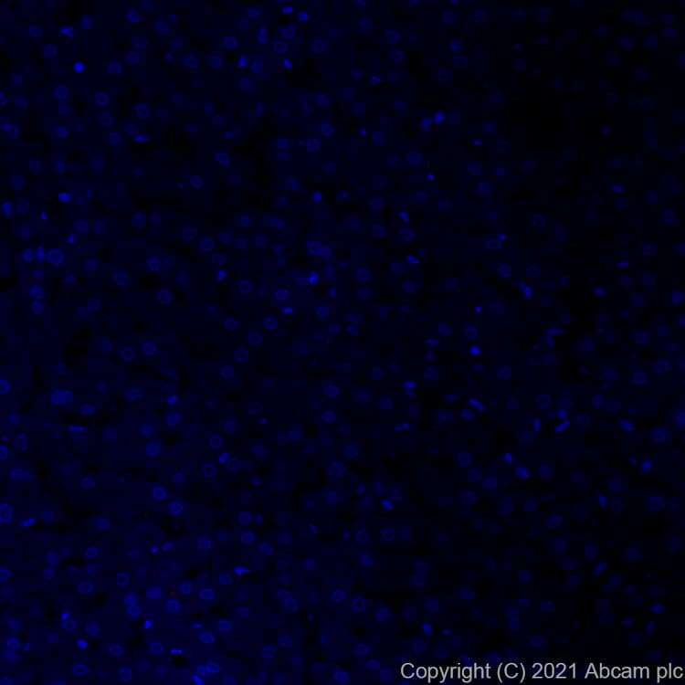 Alexa Fluor® 647 Anti-ACE2 antibody [EPR24705-45](AB283658)