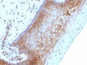 Beta 2 Microglobulin Antibody B2m 1118 Bsa And Azide Free Ab212752  Immunohistochemistry Formalin Pfa Fixed Paraffin Embedded Sections Img29378