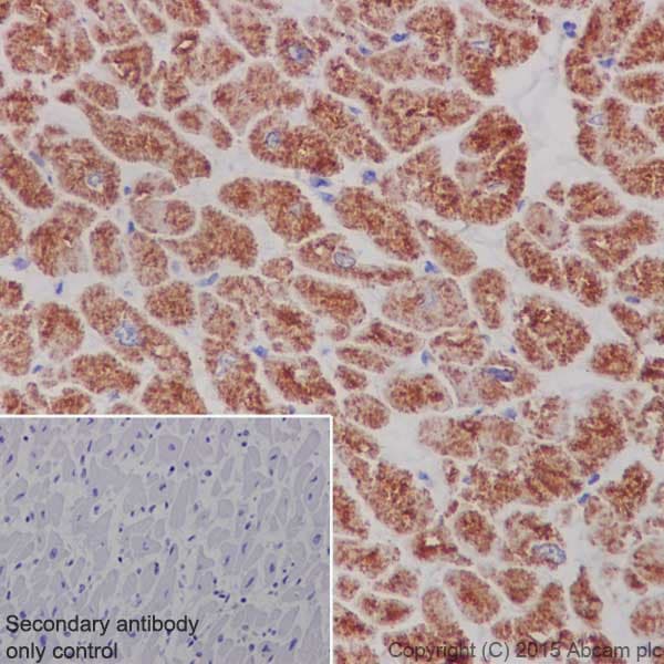 Anti-MTCO1 antibody [EPR19642](AB203917)