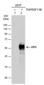 Anti-Osteoprotegerin antibody(AB183910)