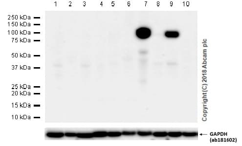 Anti-MMP9 antibody [EP1254](AB76003)