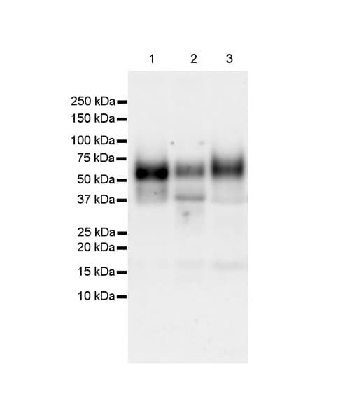 Anti-uPA Receptor/U-PAR antibody [EPR26916-73](AB307895)