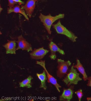 Anti-M6PR (cation independent) antibody(AB32815)