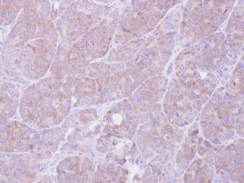 Anti-MIF antibody(AB227073)