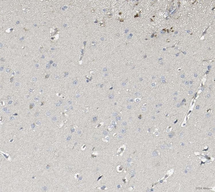 Anti-Caspase-3 antibody(AB4051)