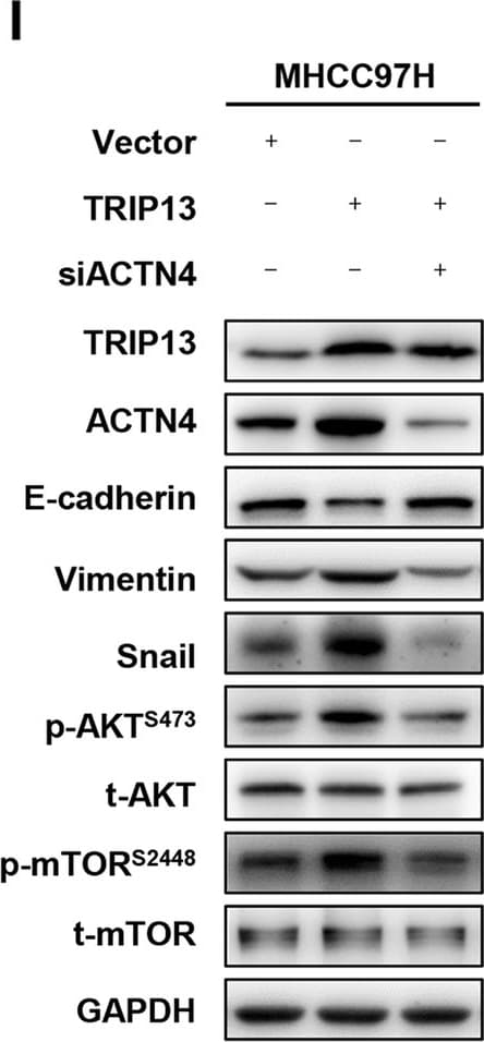 Anti-E Cadherin antibody [4A2](AB231303)