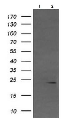 Anti-Von Hippel Lindau/VHL antibody [OTI1E1] - BSA and Azide free(AB273655)