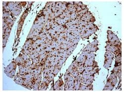 H Fabp Antibody Epr6126 Bsa And Azide Free Ab248565  Immunohistochemistry Formalin Pfa Fixed Paraffin Embedded Sections Img58912