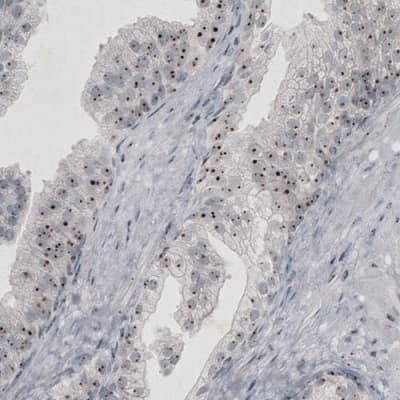 Anti-NIFK antibody [CL2240] - Nucleolar Marker(AB211871)