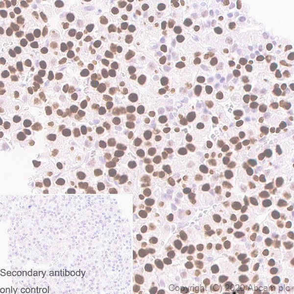 Anti-Pit1 antibody [EPR23555-203](AB273048)