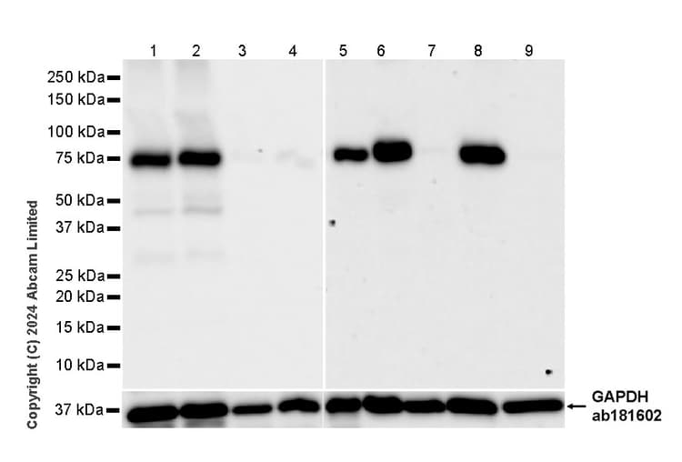Anti-PADI2 / PAD2 antibody [EPR26940-85](ab322197)