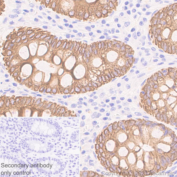 Pan Cytokeratin Antibody Epr28285 45 Bsa And Azide Free Ab308263  Immunohistochemistry Formalin Pfa Fixed Paraffin Embedded Sections Img408891