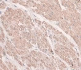 Hemojuvelin Antibody C6 Ab239495  Immunohistochemistry Formalin Pfa Fixed Paraffin Embedded Sections Img102172