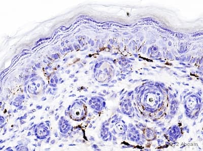 Anti-PGP9.5 antibody [13C4 / I3C4](AB8189)