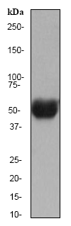 Anti-Nicotinic Acetylcholine Receptor beta/CHRNB1 antibody [EP2067Y](AB76159)