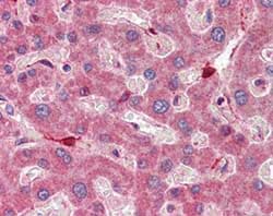 Rbp1 Antibody Ab104452  Immunohistochemistry Formalin Pfa Fixed Paraffin Embedded Sections Img45803