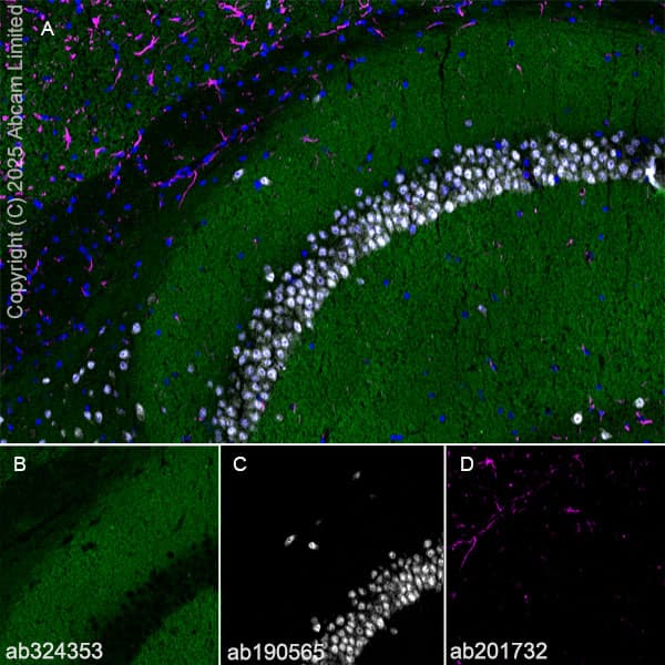 Alexa Fluor® 647 Anti-NeuN antibody [EPR12763] - Neuronal Marker(AB190565)