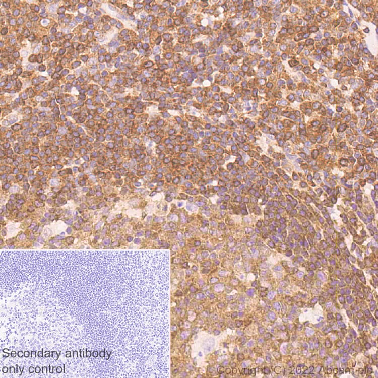 Anti-NF-kB p65 antibody [E379] - Mouse IgG2a (Chimeric)(AB307840)