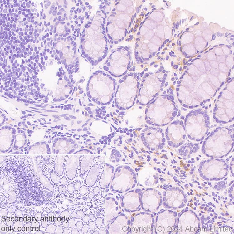 Anti-CXCL9 antibody [EPR28968-26](AB320827)