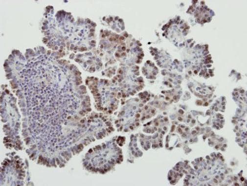 Mdm2 Antibody Chip Grade Ab226939  Immunohistochemistry Formalin Pfa Fixed Paraffin Embedded Sections Img44294