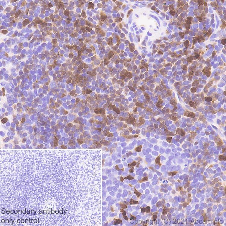 Anti-STAT4 antibody [EPR25128-48](AB284408)