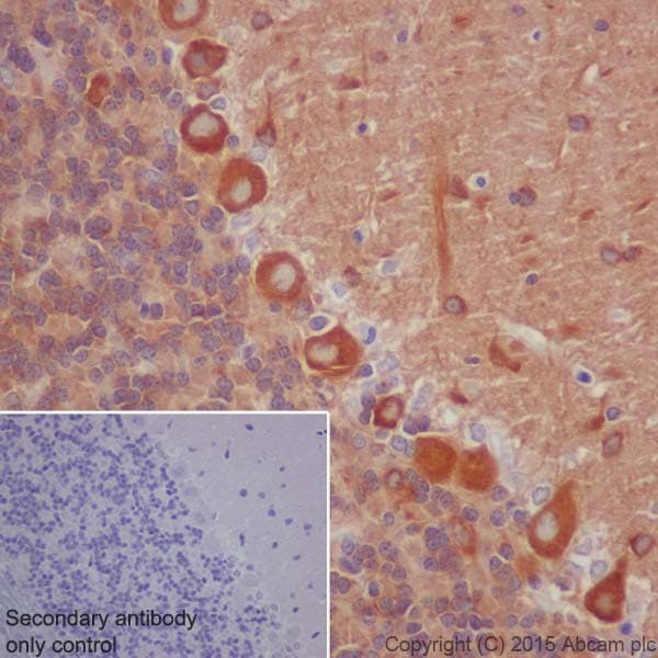 Anti-DRP1 antibody [EPR19274](AB184247)