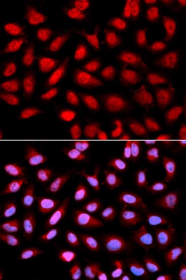 Ppp2r4 Antibody Ab186866  Immunocytochemistry Immunofluorescence Img115436