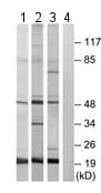 Anti-IP6K2 antibody(AB179921)