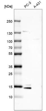 Msmp Antibody Ab185471  Western Blot Img80954