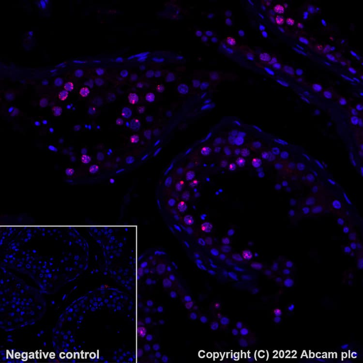 Alexa Fluor 647 Gamma H2ax Phospho S139 Antibody Ep8542y Ab195189  Immunohistochemistry Formalin Pfa Fixed Paraffin Embedded Sections Img400146