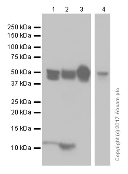Anti-Cytokeratin 8 antibody [EP1628Y] - Cytoskeleton Marker(AB53280)