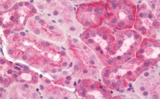 Anti-Sodium/Hydrogen Exchanger 1/NHE-1 antibody(AB230449)