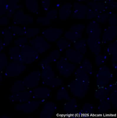 Alexa Fluor® 488 Anti-Cytokeratin 14 antibody [EP1612Y](AB192055)