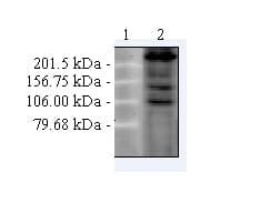 Anti-CACNA1C antibody [S57](AB84814)