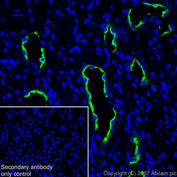 Anti-Aquaporin 2 antibody [EPR21080] - BSA and Azide free(AB230170)