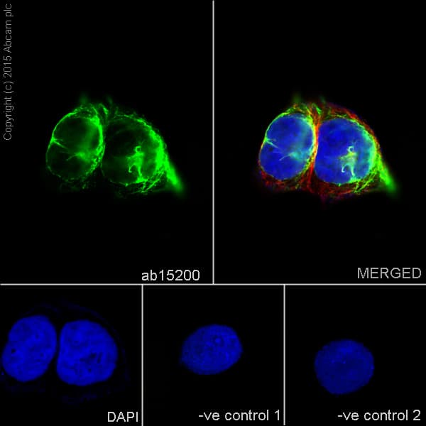 Anti-Desmin antibody - Cytoskeleton Marker(AB15200)