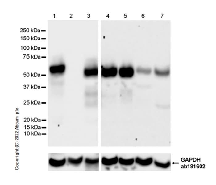 Anti-IRF8 antibody [EPR26382-10] - BSA and Azide free(AB306553)