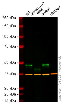 Anti-Cyclin E1 antibody [CCNE1/2460](AB238081)