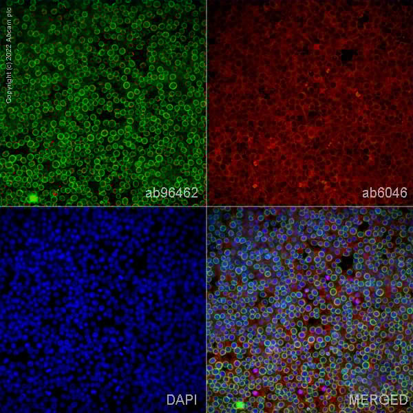 Anti-beta Tubulin antibody - Loading Control(AB6046)