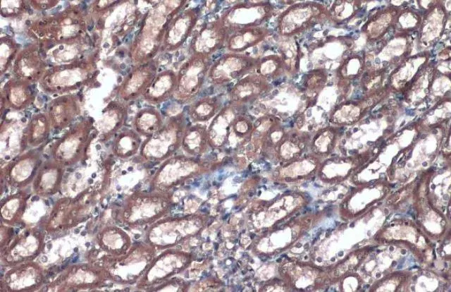 Anti-Villin antibody(AB97512)