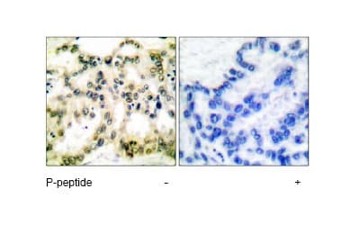 Cyclin B1 Phospho S126 Antibody Ab55184  Immunohistochemistry Formalin Pfa Fixed Paraffin Embedded Sections Img1600