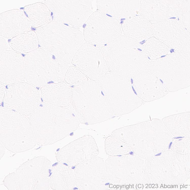 Anti-TMS1/ASC antibody [RM1049](AB309497)