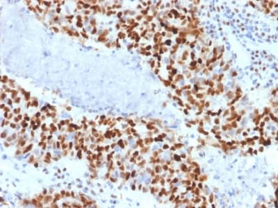Anti-Cyclin E1 antibody [CCNE1/2460](AB238081)